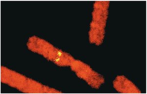 Fluorescent tagging of gene loci on chromosomes