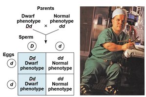 Punnett square showing inheritance of achondroplasia