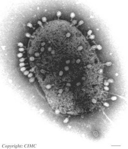 Bacteriophage infecting E. coli