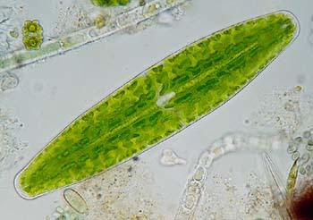 Microscopic image of a protist