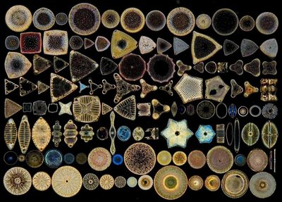 Radiolarian and Foraminiferan with filose pseudopodia