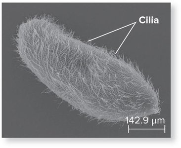 Ciliate protist covered with cilia