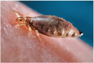 Human body louse feeding on host