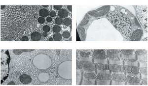 Examples of cell specialization