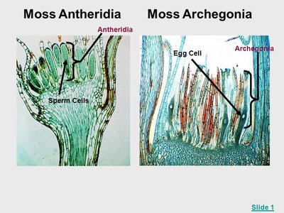 Microscope images of moss antheridia and archegonia