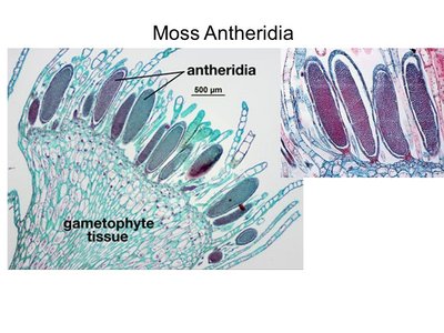 Microscope image of moss antheridia