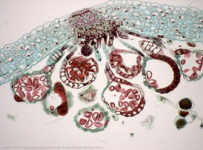 Microscope image of fern sporangia