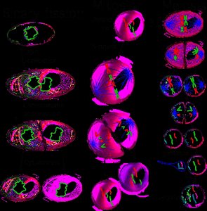 Stages of mitosis (fluorescent microscopy)