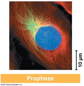 Fluorescent micrograph of prometaphase