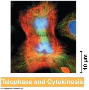Comparison of cytokinesis in animal and plant cells