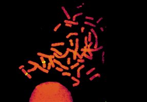 Fluorescent image of chromosomes