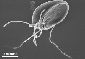 Excavata protist with flagella