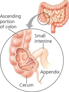 Junction of small and large intestines, showing cecum and appendix