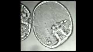 Sea Urchin Embryonic Development