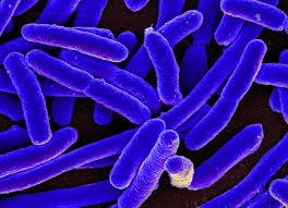 E. coli cells