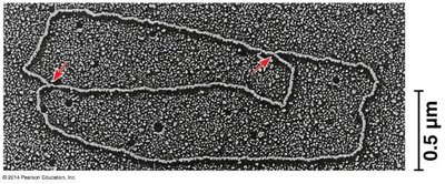 Electron micrograph of E. coli DNA replication