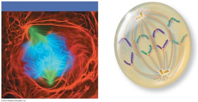 Anaphase: chromatids separating and moving to poles