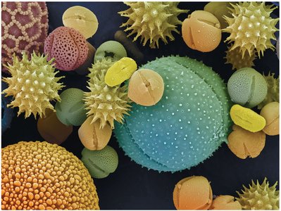 Diverse pollen grains under microscope