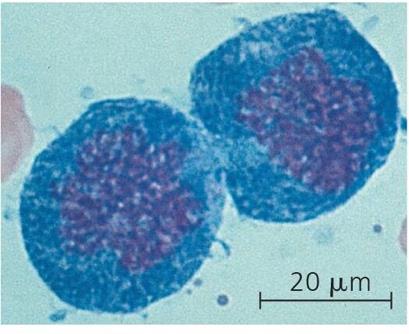 Microscopic image of two dividing cells