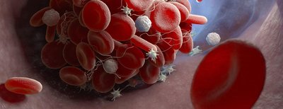 Platelets and blood clot formation