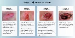 Pressure sore cross-section