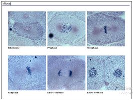 Stages of mitosis in animal cells
