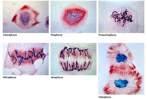 Mitosis stages in onion root tip