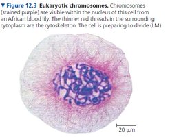 Eukaryotic chromosomes visible within the nucleus