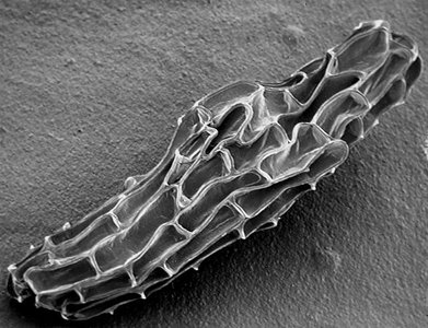 Orchid seed under microscope