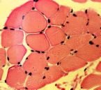 Light microscope image of muscle post-injury