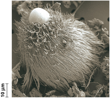 Ciliate with cilia visible under electron microscope