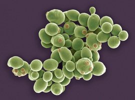 Asexual reproduction: yeast