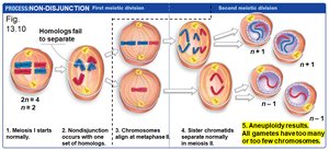 Non-disjunction: Meiosis I