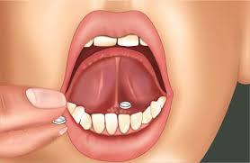 Sublingual drug administration