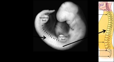 Notochord in embryonic development
