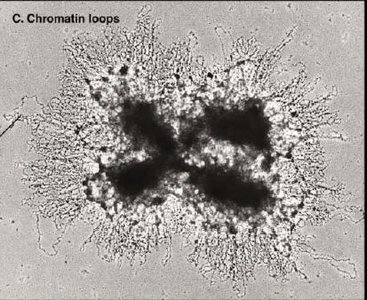Electron micrograph of metaphase chromosome