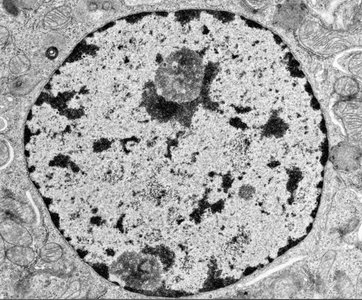 Electron micrograph of nucleus showing euchromatin and heterochromatin