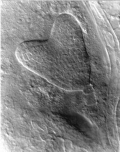 Microscopic image of heart-shaped stage in plant embryo development