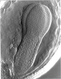 Microscopic image of torpedo stage in plant embryo development