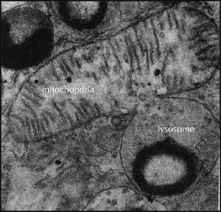 Electron micrograph showing lysosome and mitochondria