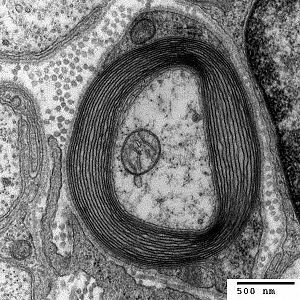 Transmission electron micrograph of a cell structure