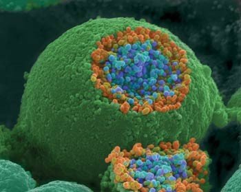 Scanning electron micrograph of a cell surface