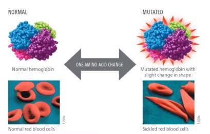 Mutation in hemoglobin protein affects red blood cells
