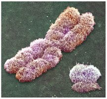 Human X and Y chromosomes