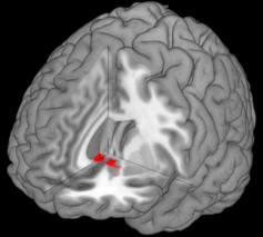 Human brain regions involved in reward and pleasure