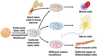 Therapeutic cloning and stem cell differentiation