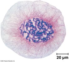 Eukaryotic chromatin in interphase