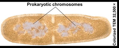 Prokaryotic cell showing chromosomes