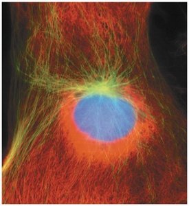 Interphase cell with visible nucleoli and chromatin
