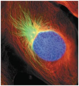 Prophase: spindle and chromosomes